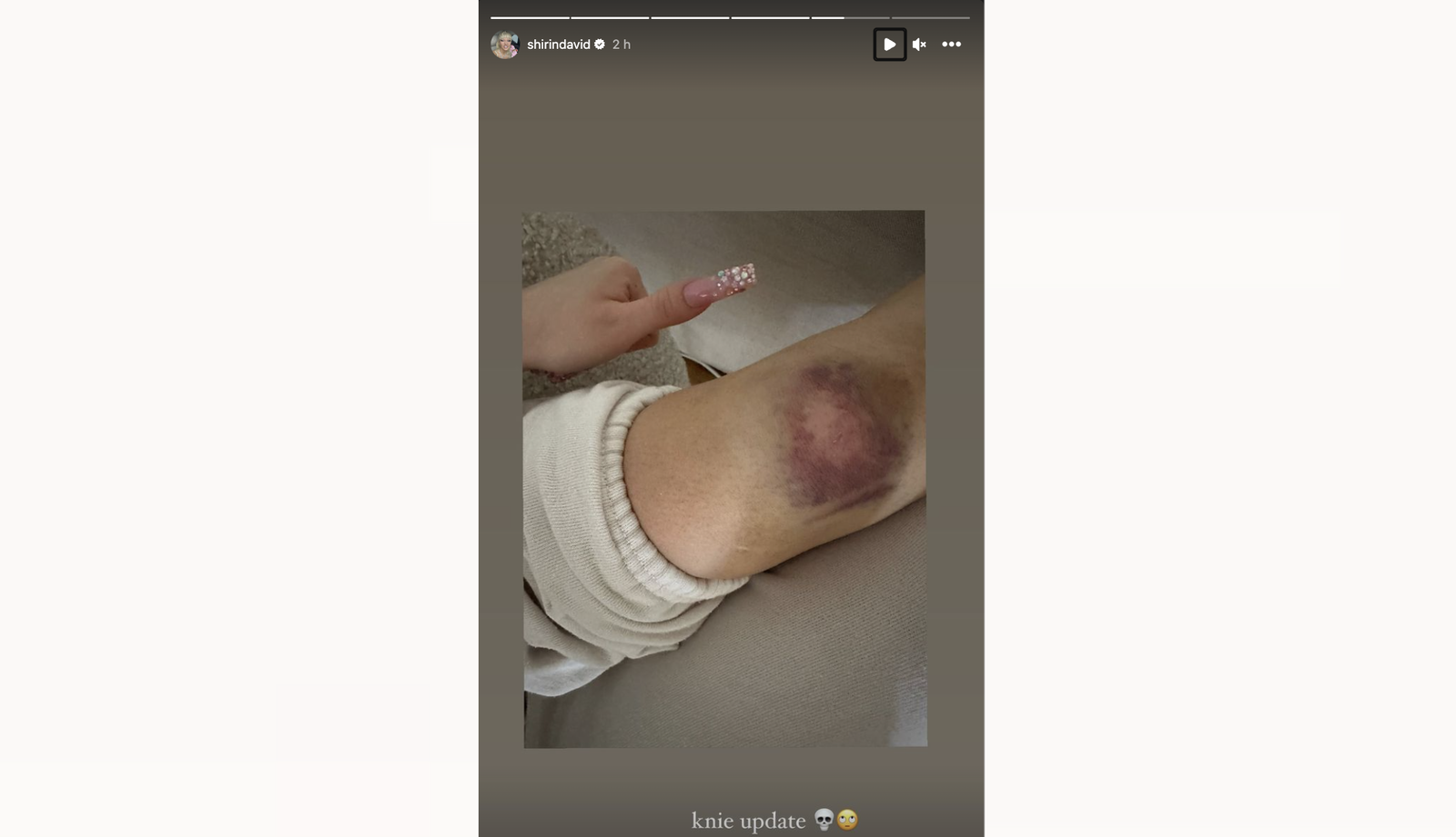 Shirin David - Instagram