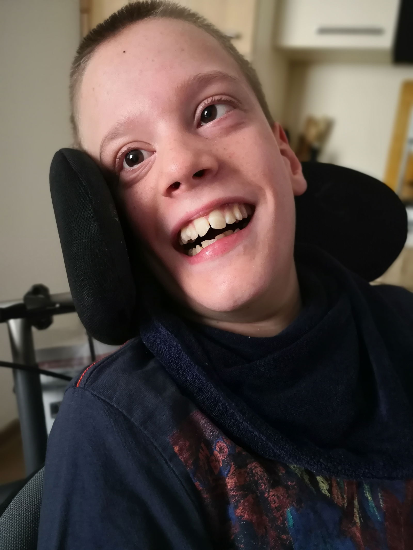 Paul leidet an Epilepsie