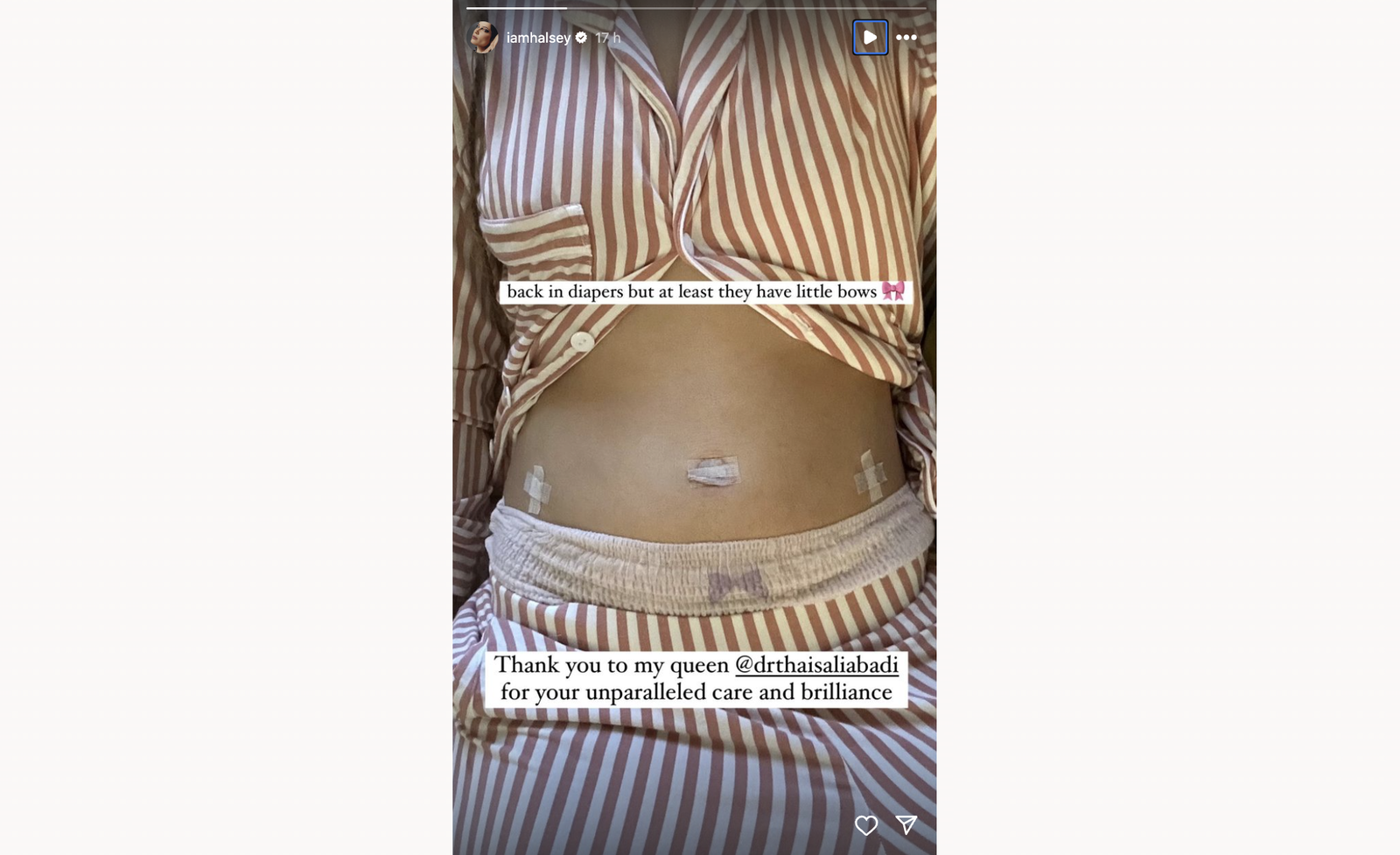 Halsey - Endometriose