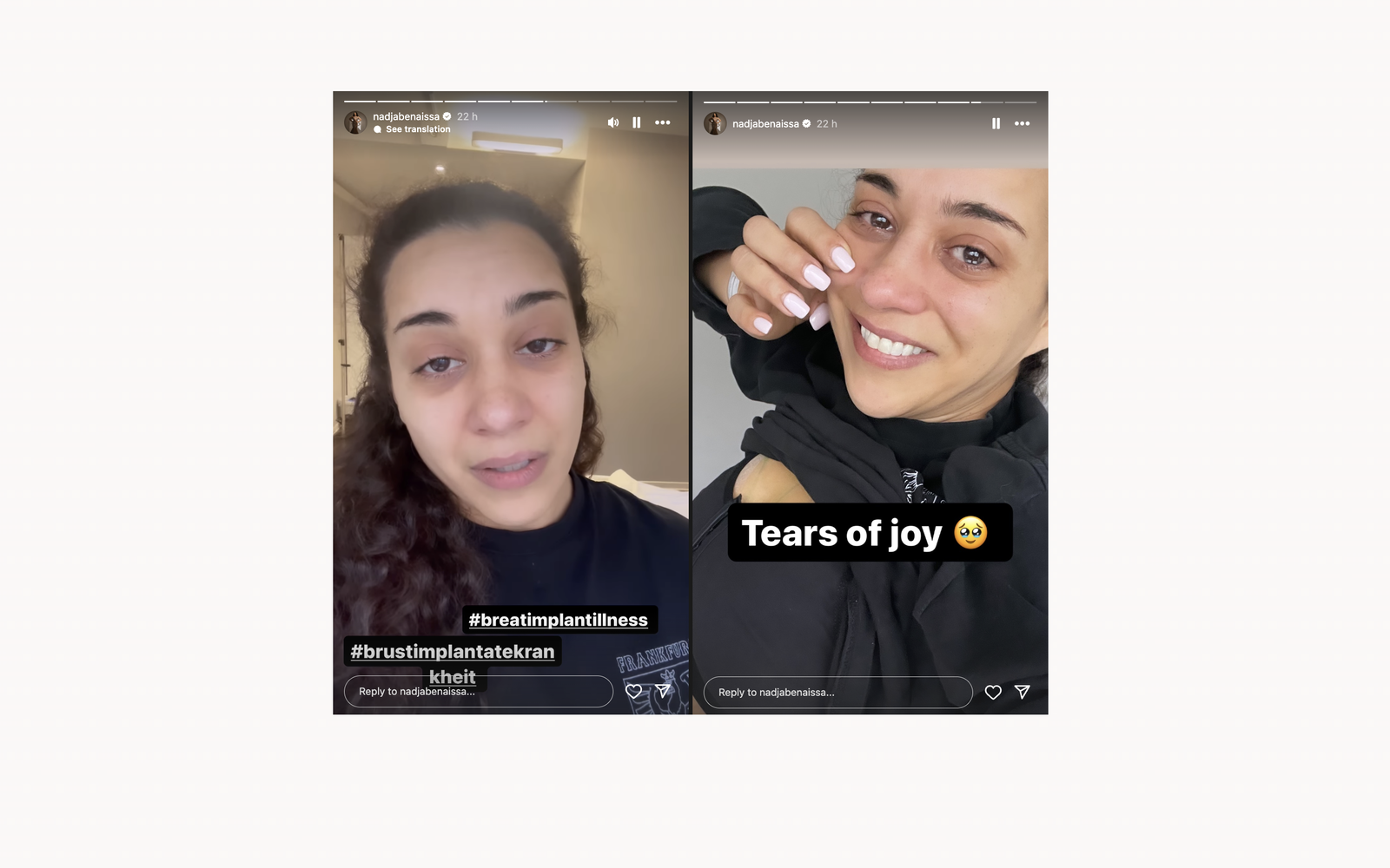 Nadja - No Angels - Instagram Implantate