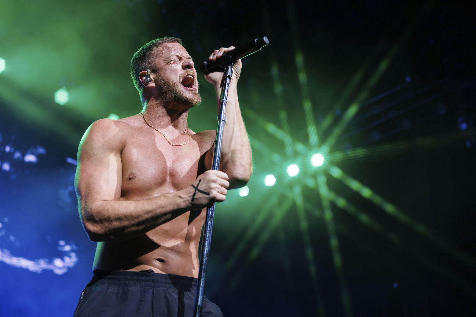 Imagine Dragons Leadsänger Dan Reynolds hat optisch eine ziemliche Wandlung hingelegt 