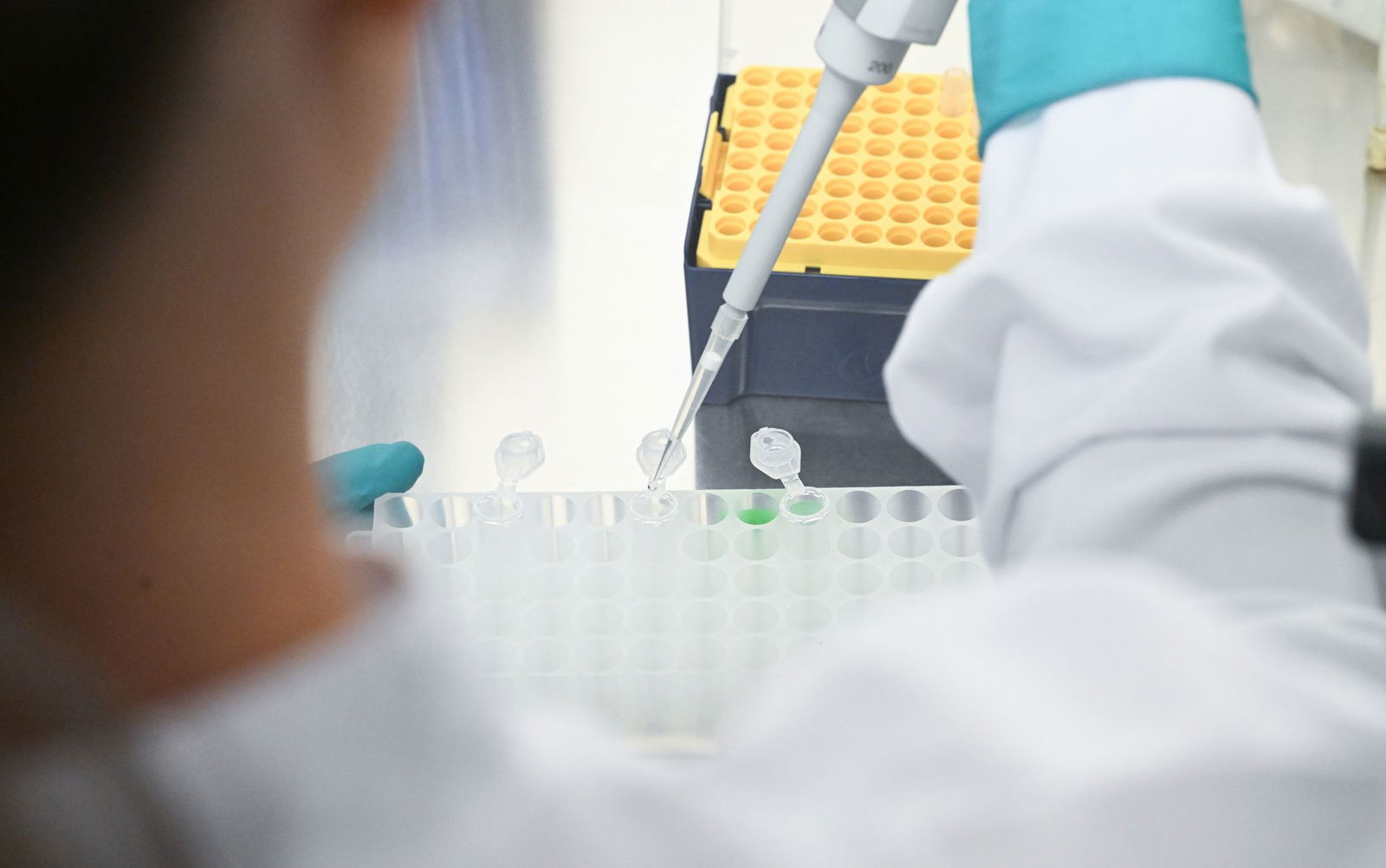 In Rheinland-Pfalz wurde 2023 bei knapp 240 Menschen Gallengang- oder Gallenblasenkrebs diagnostiziert. (Symbolbild).