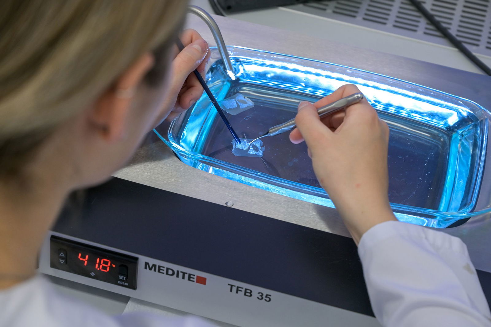 Die Aggressivität gegenüber Lebensmittelkontrolleuren nimmt zu. (Archivbild)