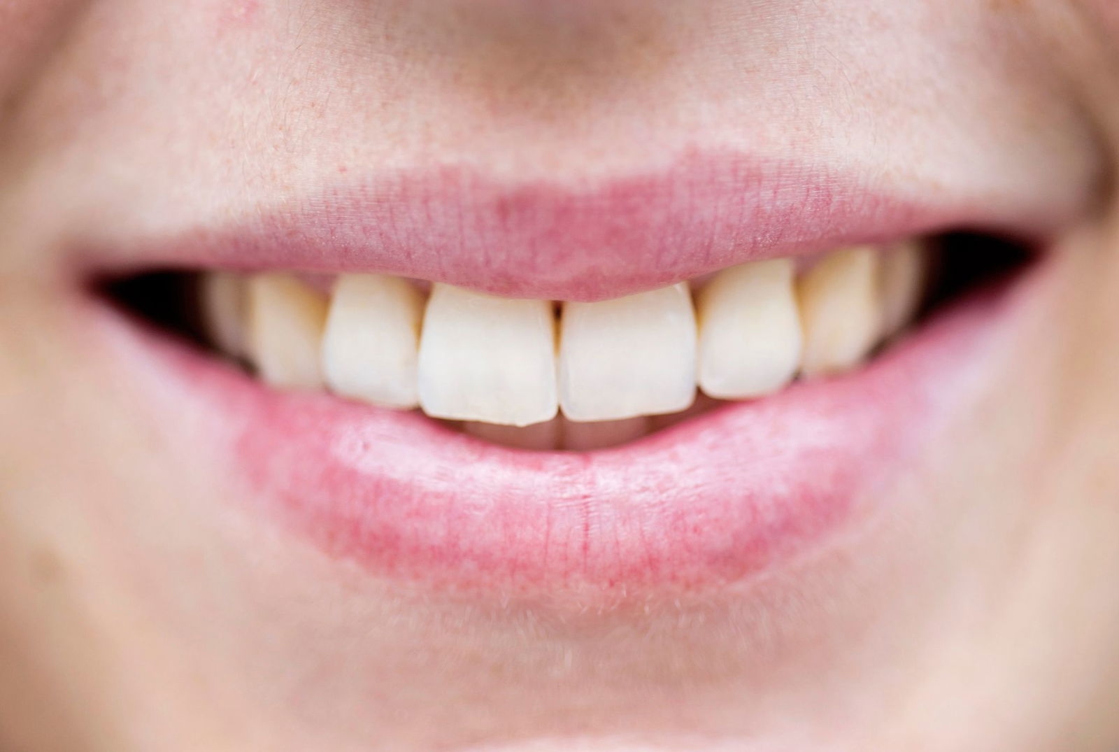 50,5 Prozent der Menschen in Rheinland-Pfalz sind Frauen. (Symbolbild)
