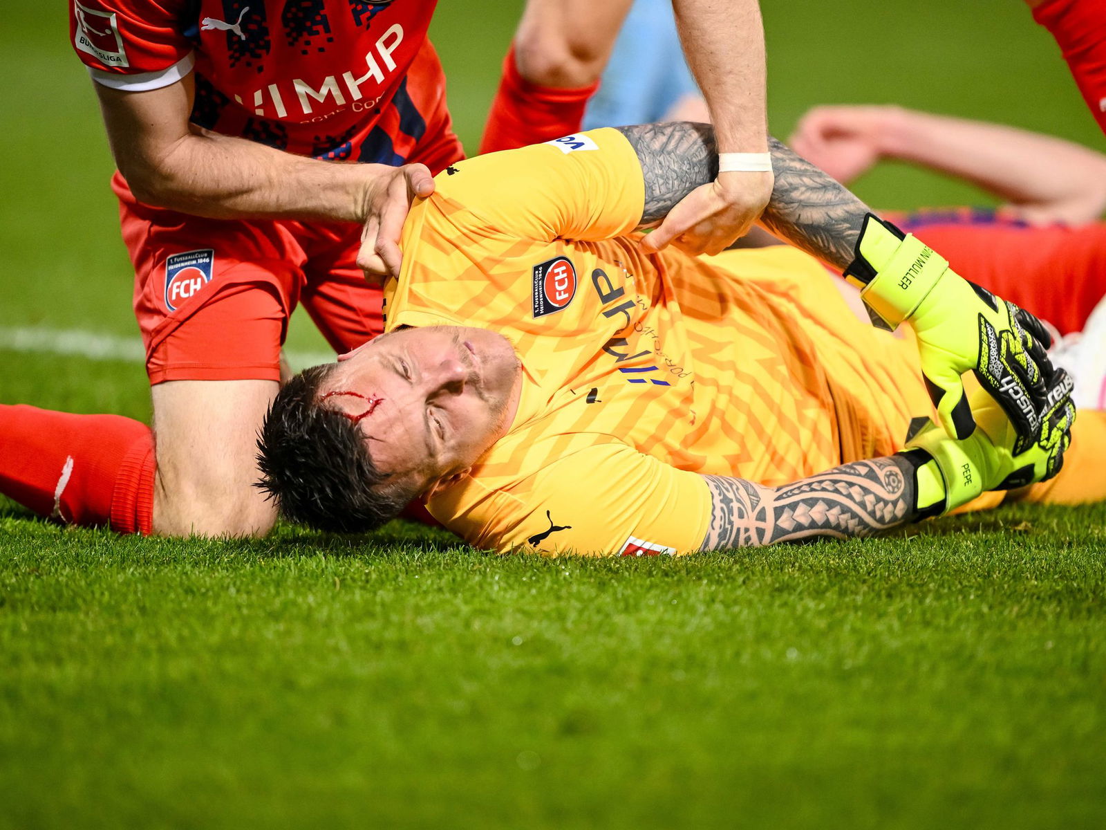 Kevin Müller hat es mit einer Gehirnerschütterung heftig erwischt.