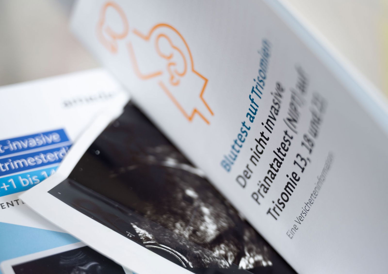 Im Südwesten nutzen Schwangere vermehrt Bluttests zur Frühdiagnostik von Gendefekten wie etwa Trisomien. (Archivbild)