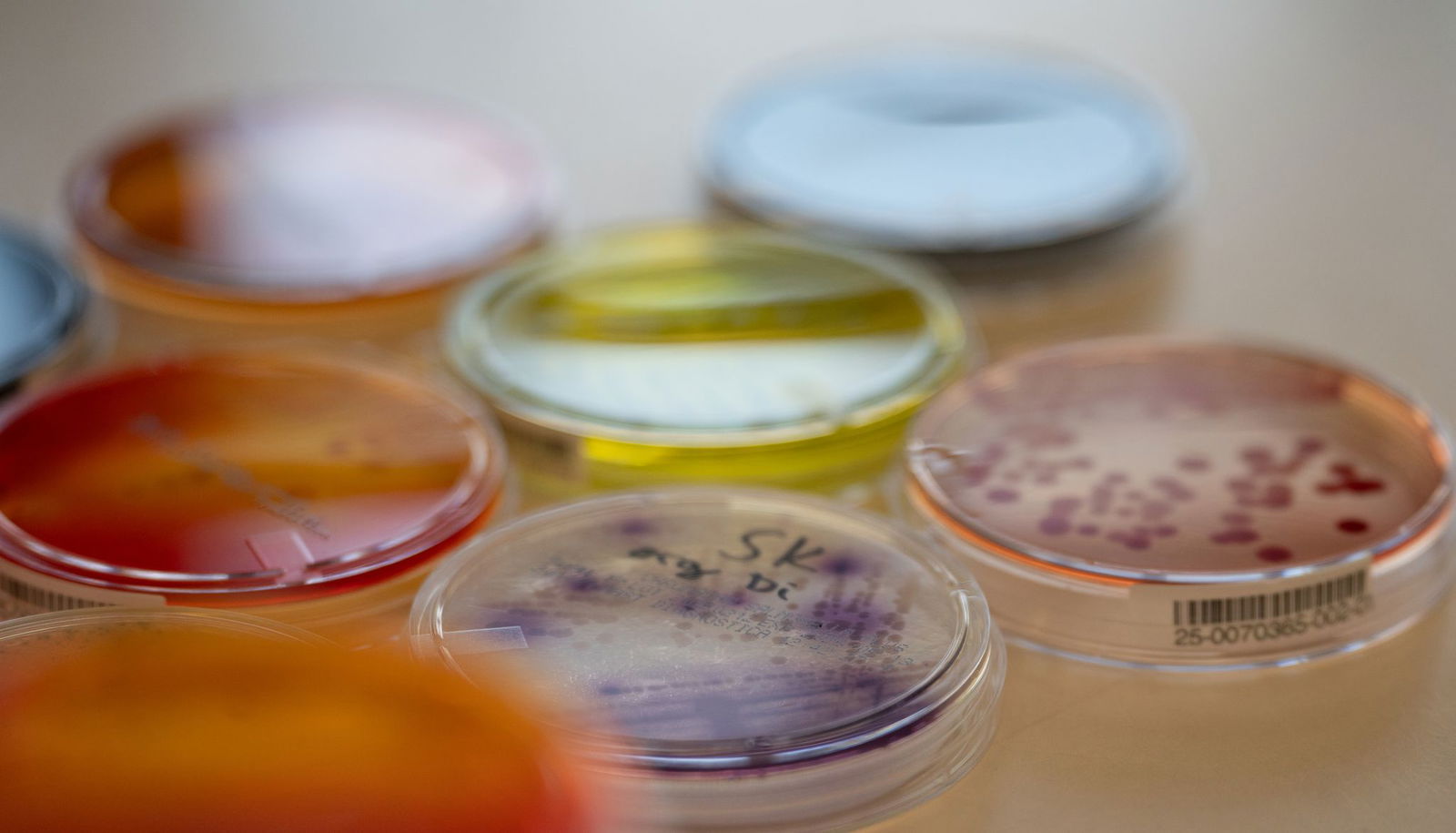 Das Landesuntersuchungsamt untersucht Tausende Stichproben. (Symbolbild)