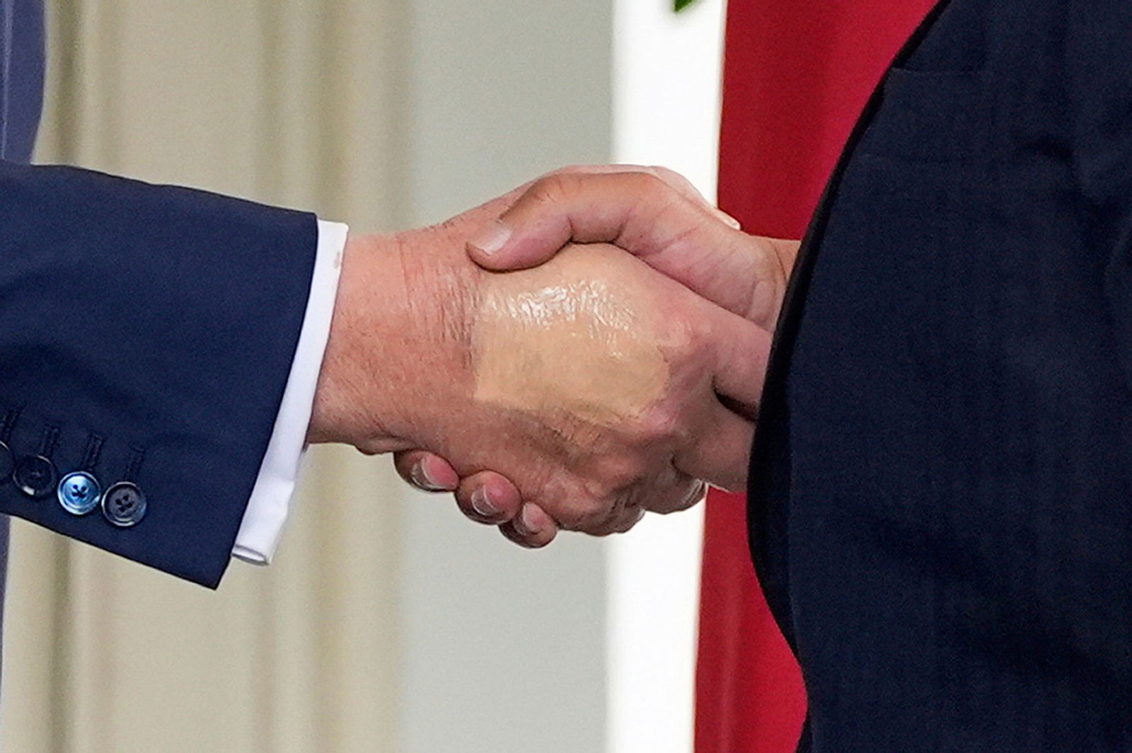 Das Weiße Haus gibt Details zu Trumps Gesundheitszustand preis.