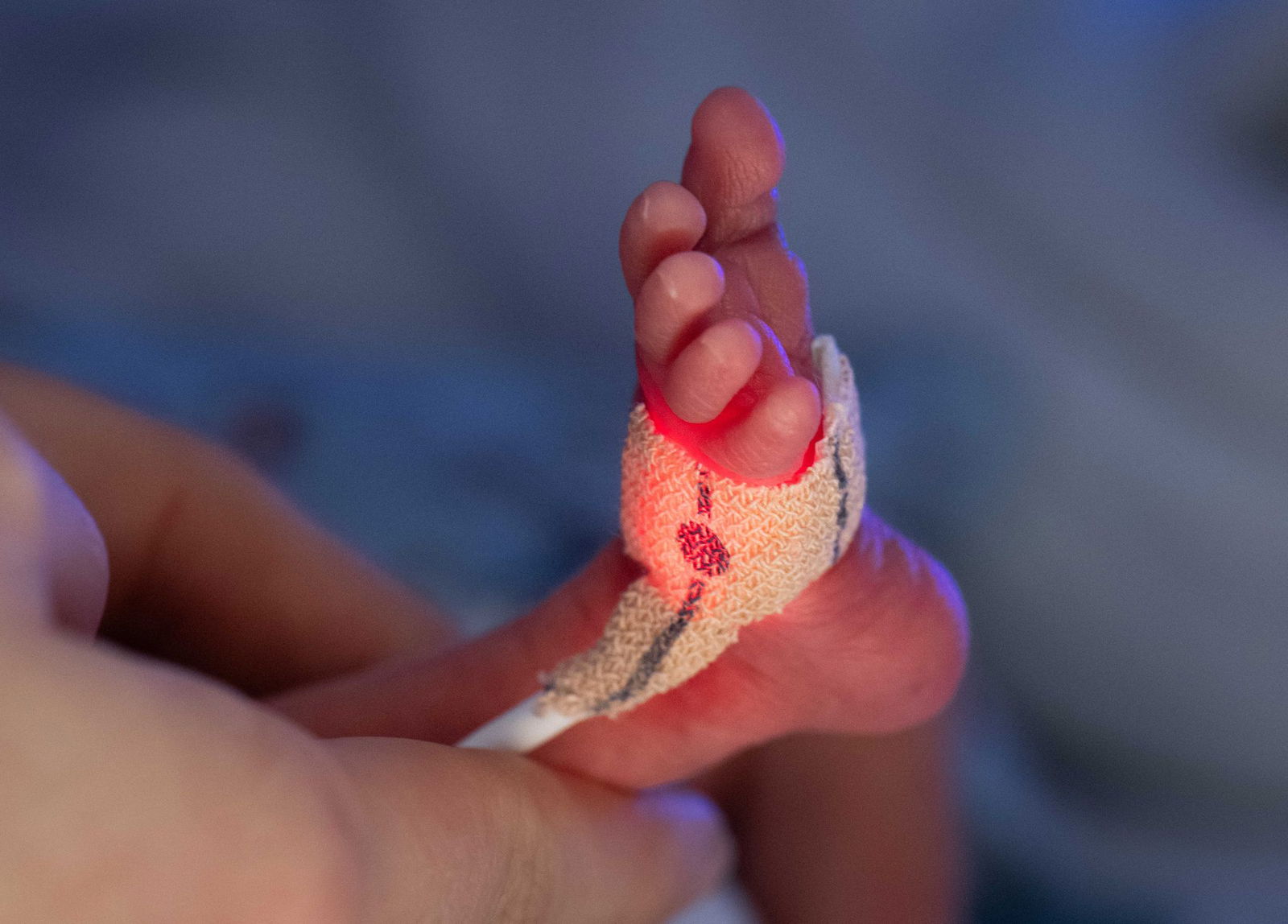 Für die Versorgung von Frühgeborenen gibt es Mindestmengen, die Krankenhäuser erreichen müssen, um die Behandlung bezahlt zu bekommen. Drei Bundesländer sehen dadurch ihre Rechte verletzt und klagen in Karlsruhe. (Archivbild)