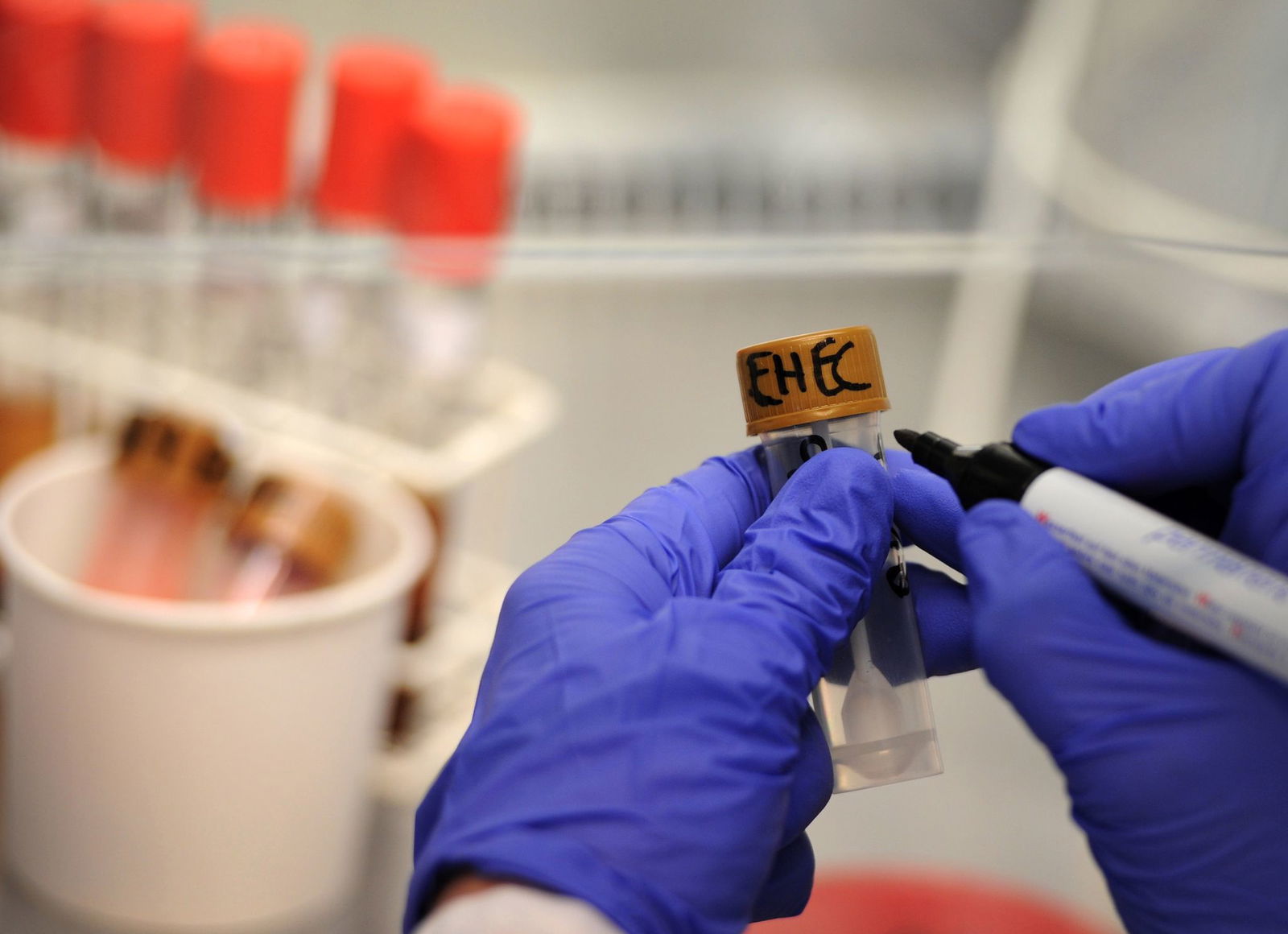 Jedes Jahr wird in Baden-Württemberg eine dreistellige Zahl von Ehec-Fällen registriert. (Archivbild)