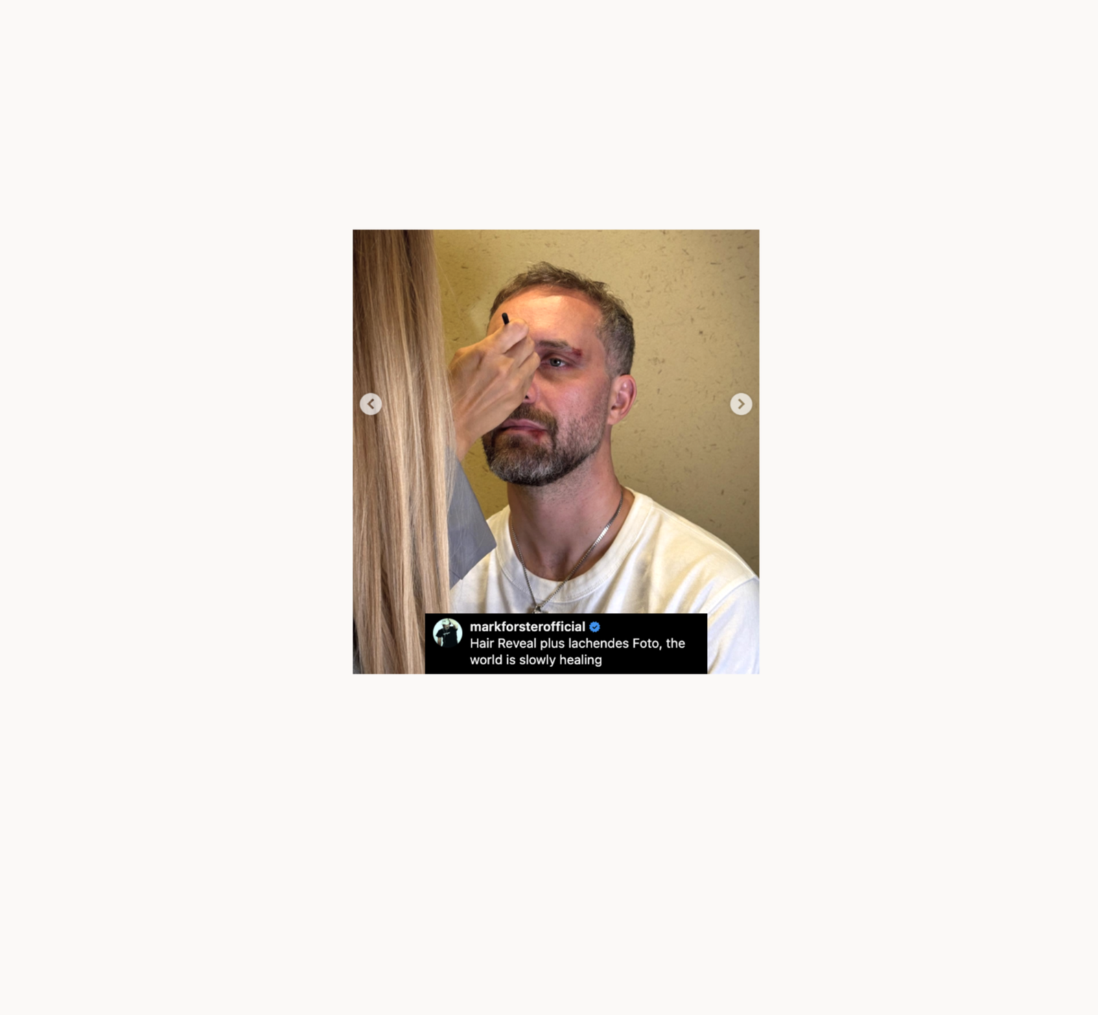 Mark Forster ohne Kappe