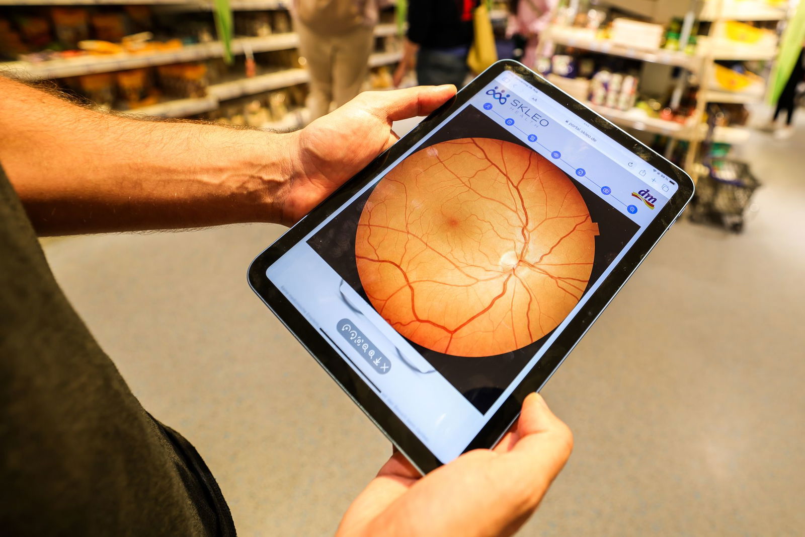 Ein Foto zeigt Details der Netzhaut.