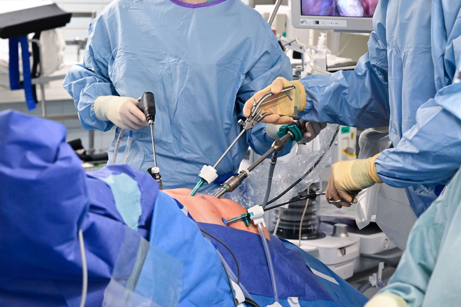 Behandlungsfehler führen laut dem Medizinischen Dienst zu Kosten in Milliardenhöhe. (Symbolbild)