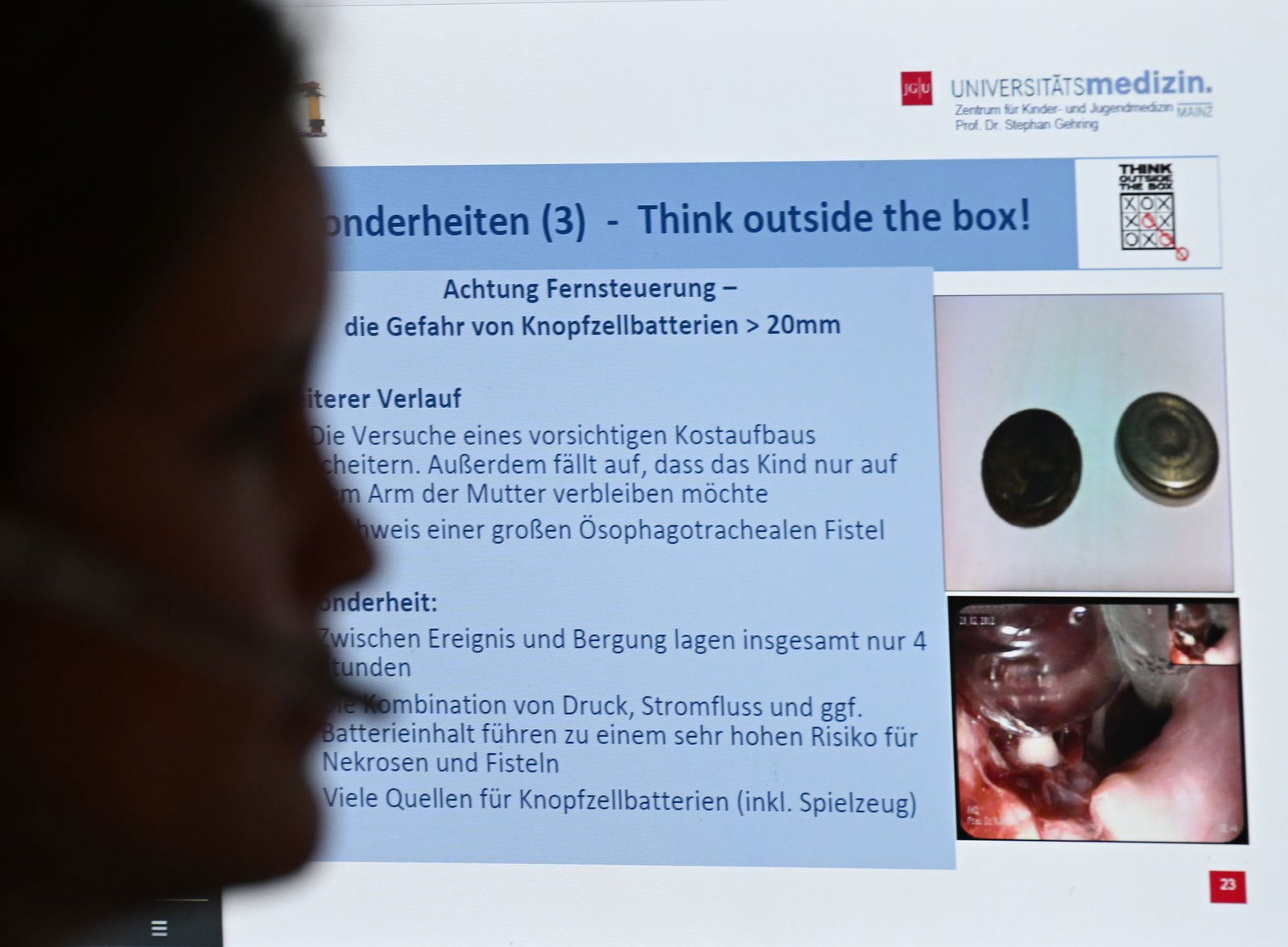 Mal werden Informationen zu Batterie-Knopfzellen benötigt, mal zu Inhaltsstoffen von verschlucktem Reinigungsmittel. (Archivbild)