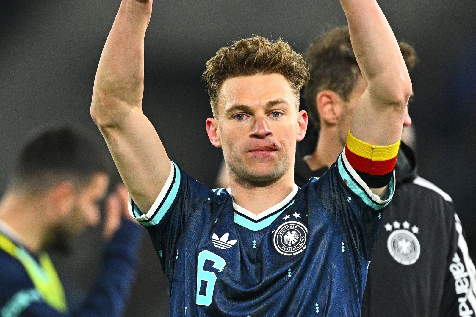 Joshua Kimmich feiert mit einer Verletzung an der Lippe den Sieg in der Schweiz. 