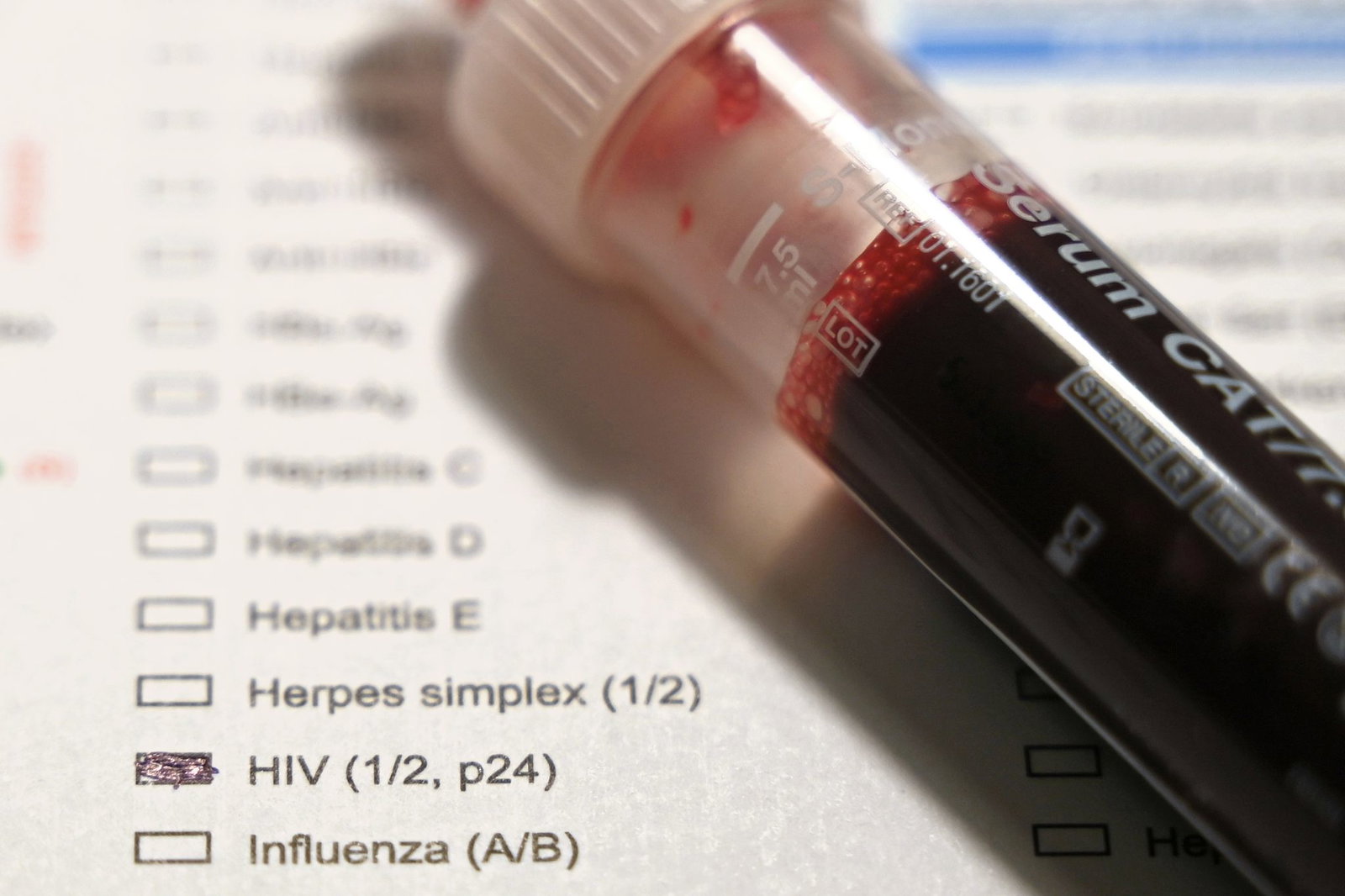 Bei Aids-Hilfen gehört eine Blutprobe zu HIV-Tests. (Archivbild) 