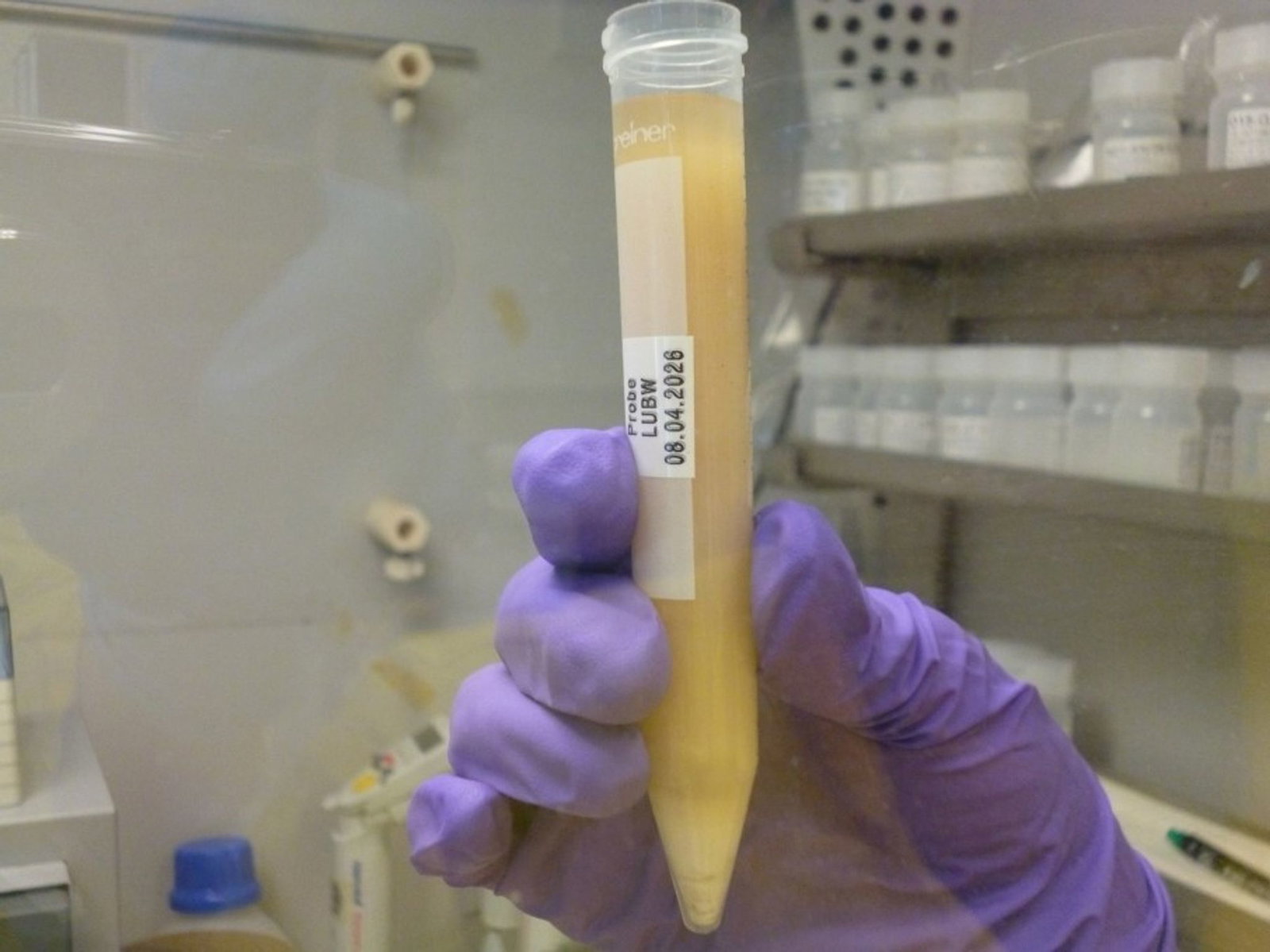 Die verdächtige Substanz - hier ist eine Probe davon zu sehen - wird nun noch weiter von Experten untersucht. 