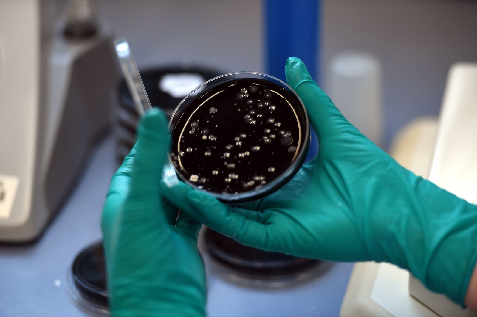 Nach einem Legionellen-Ausbruch in Ulm sind zwei Menschen gestorben. (Symbolbild) 