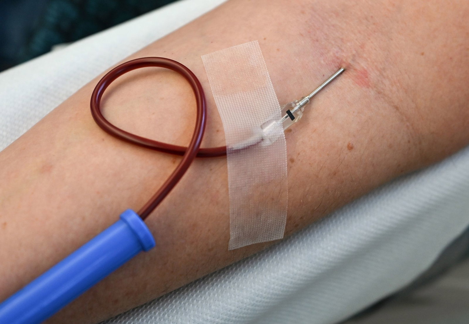 Es wird derzeit wenig Blut gespendet - mit Folgen. (Symbolbild)
