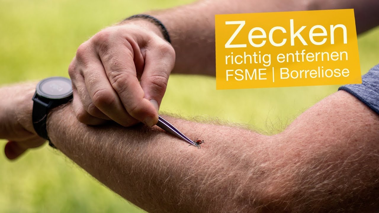 Zecken entfernen mit Pinzette & Zeckenzange 🌿 FSME & Borreliose vermeiden