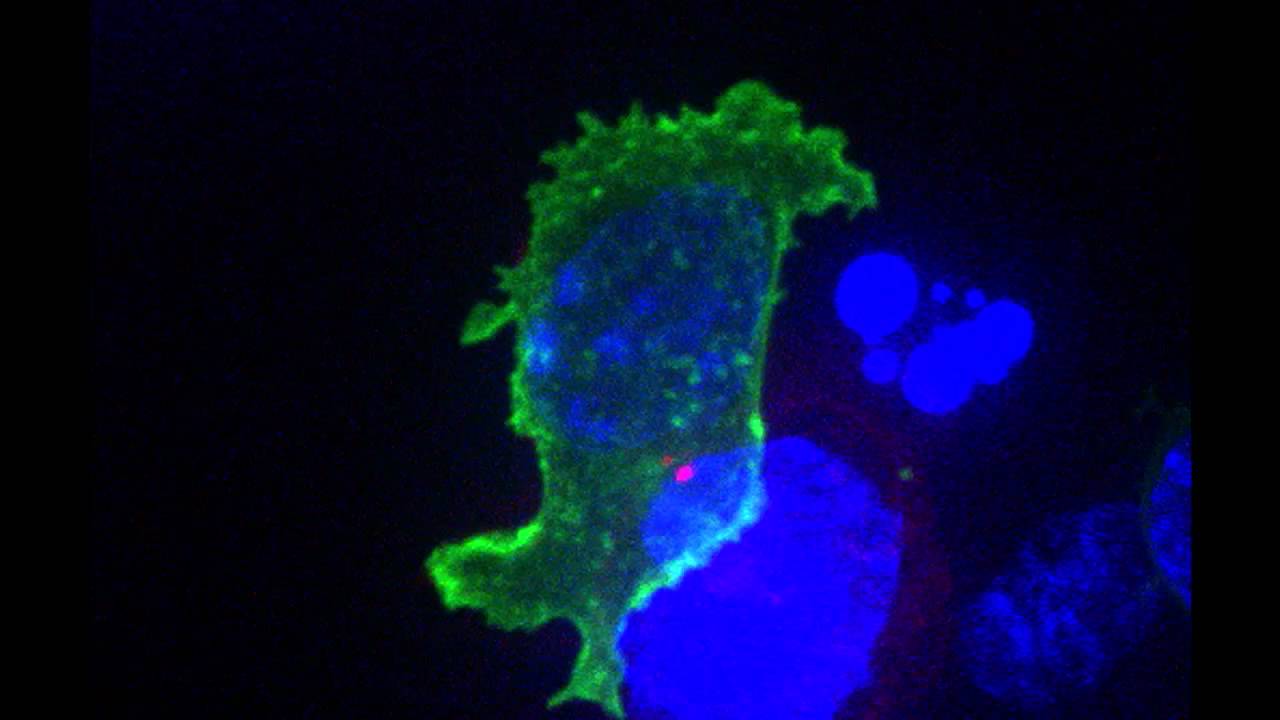 Killer T cell attacking cancer