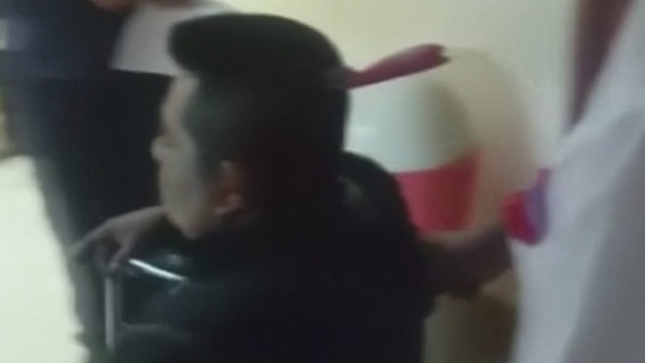 Man with a knife lodged in his head walks into hospital