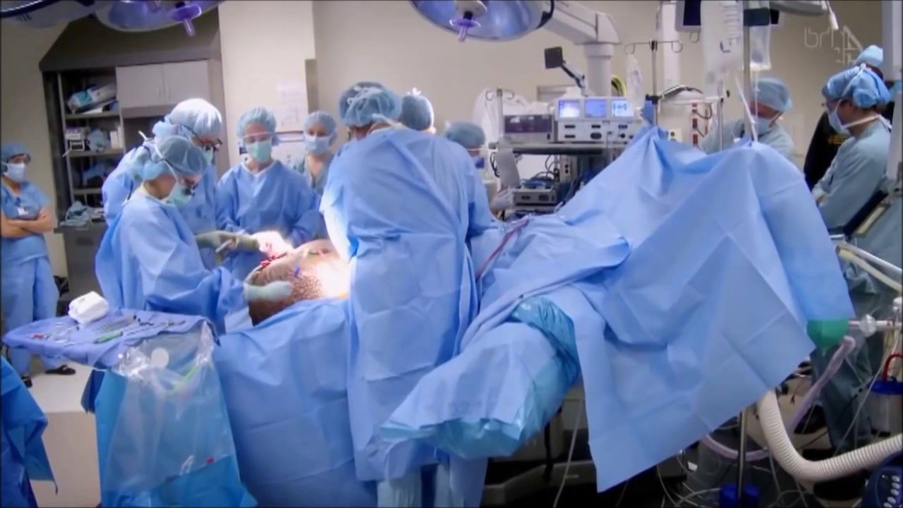 Mexican Woman's Weight Doubled to 275 Pounds... Find Out Why! Tumors and Cysts