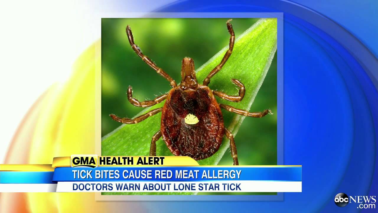 Lone Star Tick Bite Can Make You Allergic to Red Meat