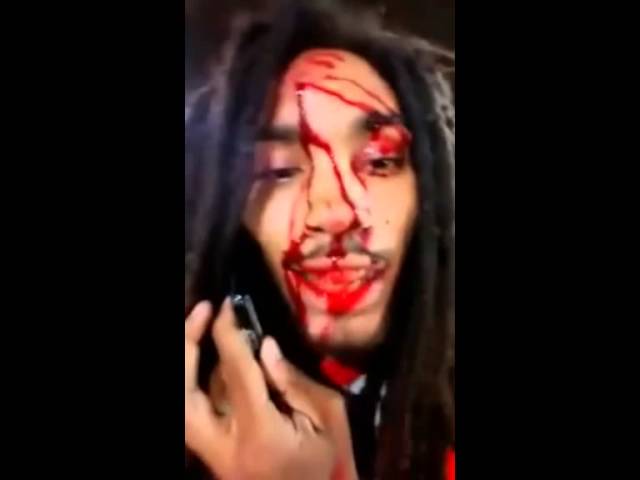 #WTH: Compton Rapper Teriq Royal Makes A SELFIE Video After Being SHOT IN THE HEAD With An AK 47!