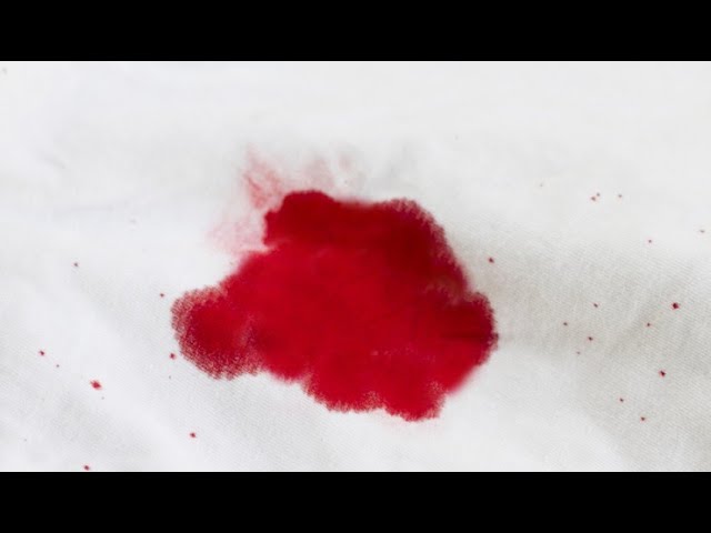 VirginiaCare das künstliche Jungfernhäutchen in ZDF Doku vorgestellt.