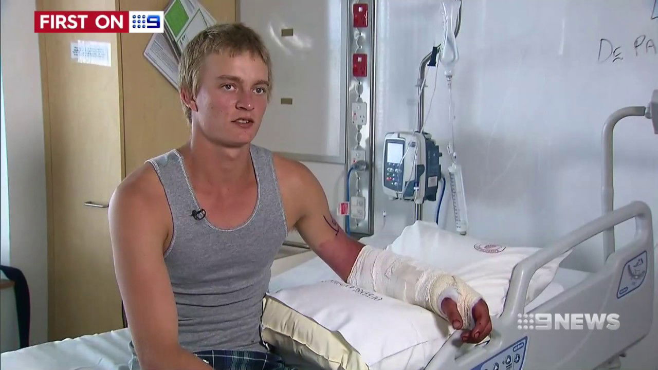 Crocodile Attack | 9 News Perth